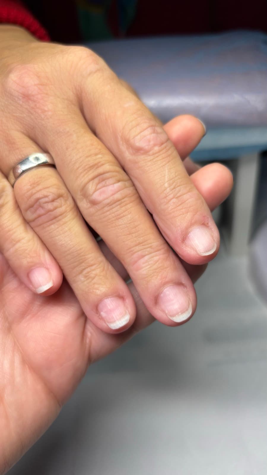 Antes — Uñas cortas y disparejas